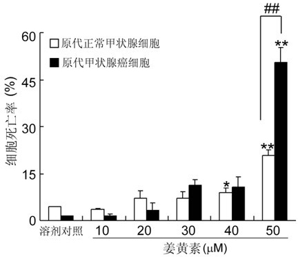 Application of curcumin in preparation of thyroid carcinoma therapeutic agent