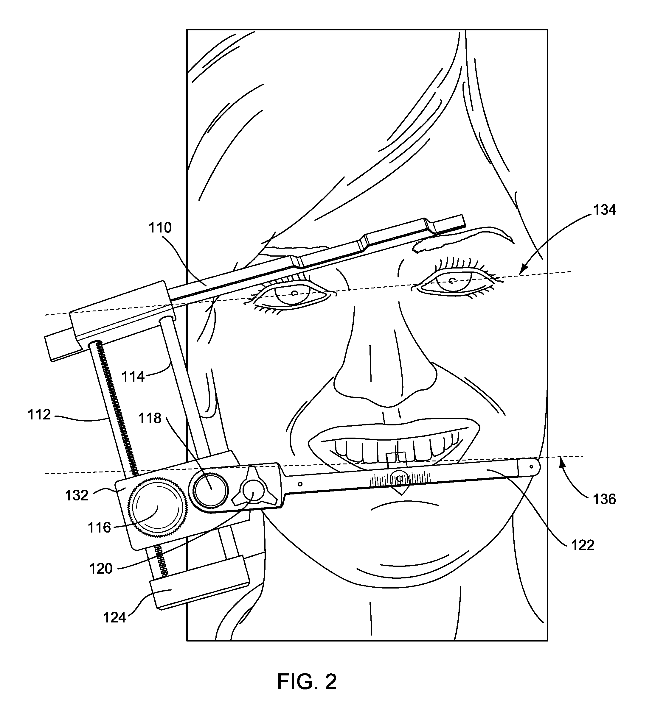 Dental measuring device