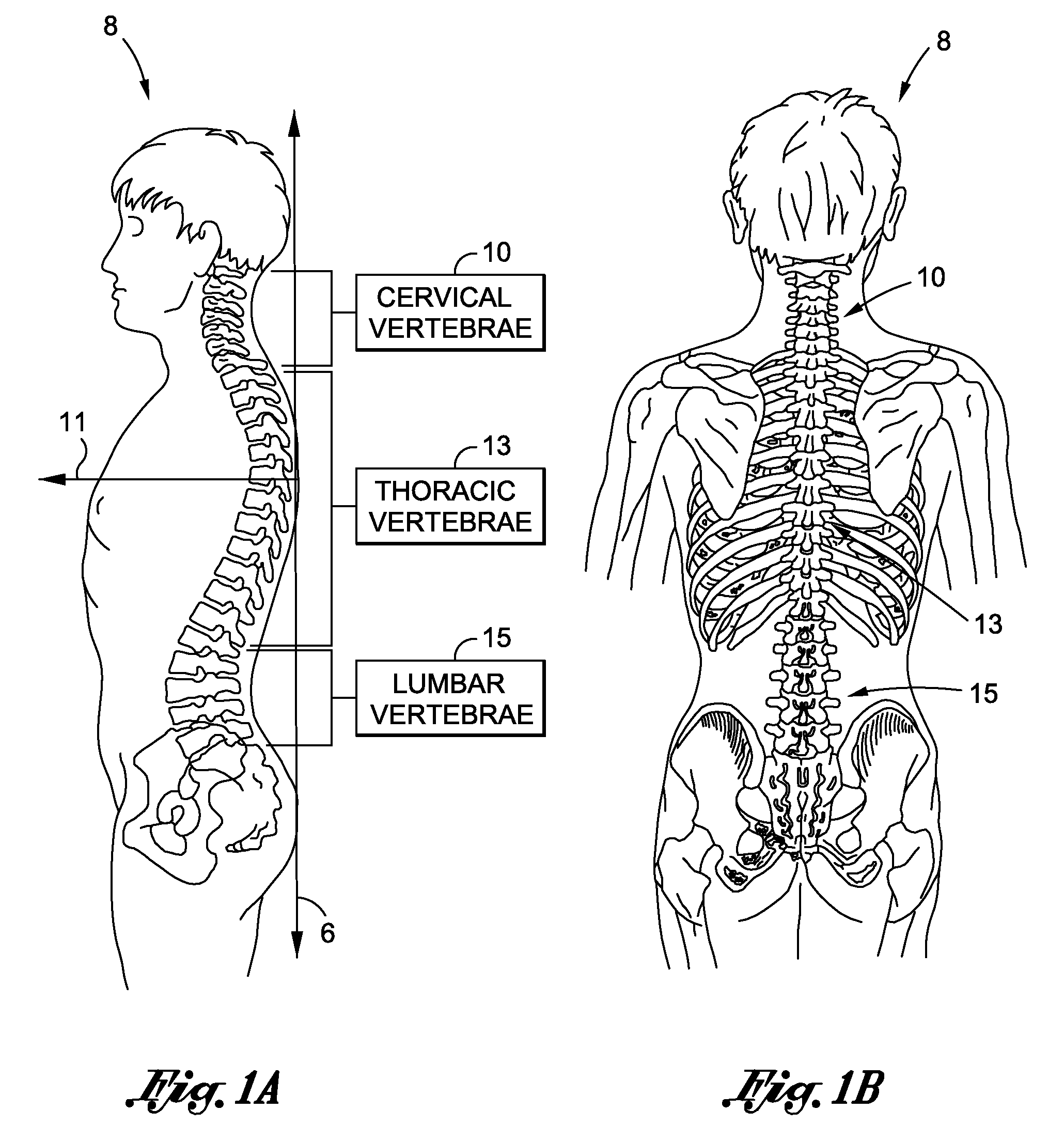 Cervical spine traction apparatus and method