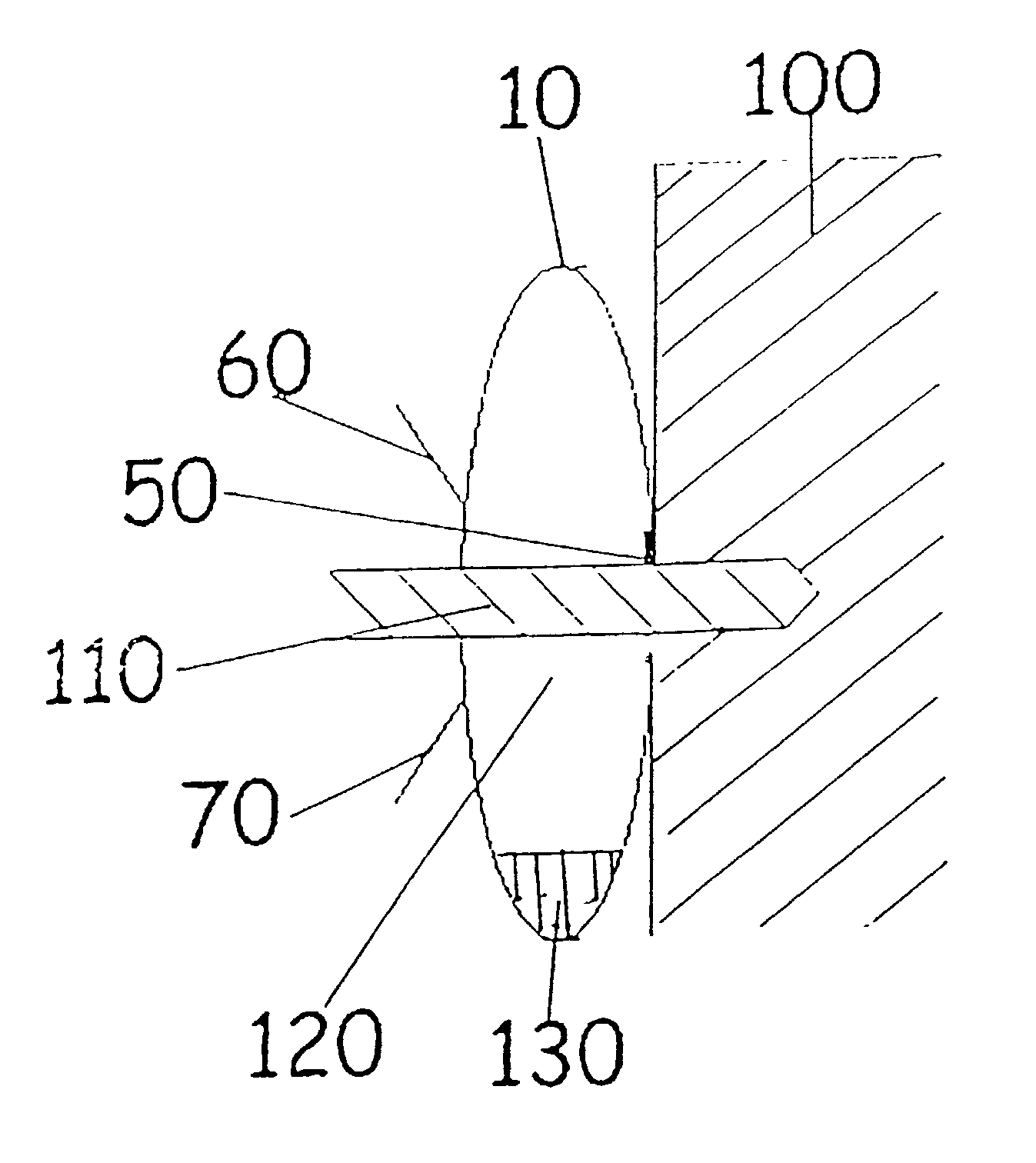 Debris collection device and method