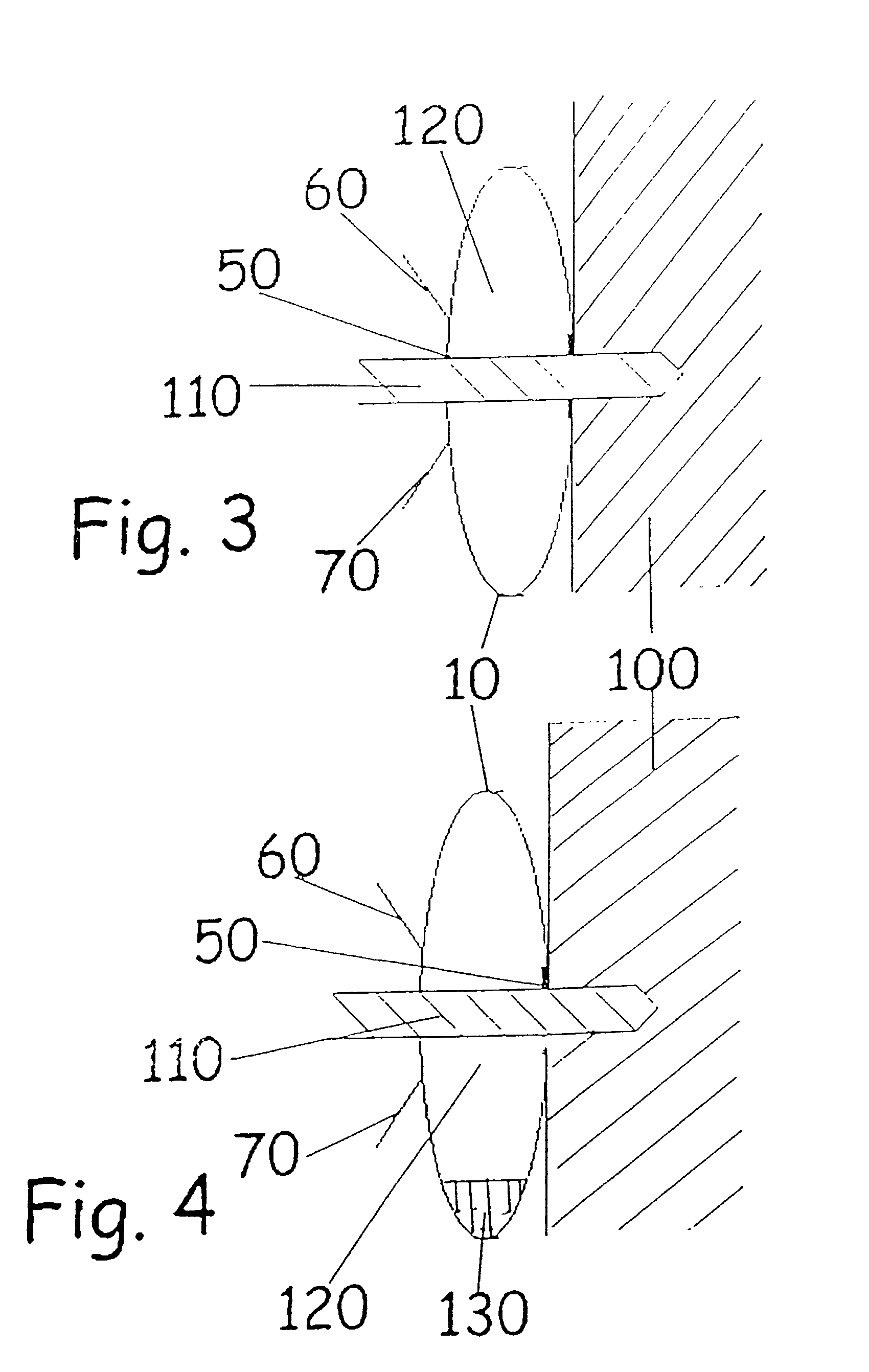 Debris collection device and method