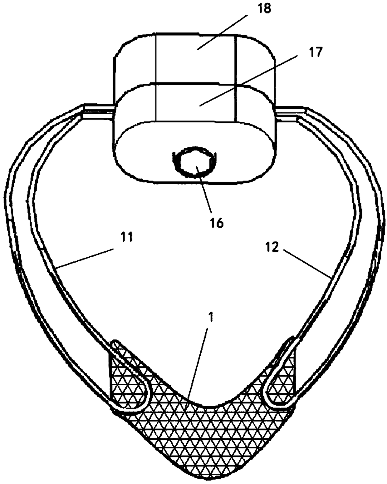 An adjustable urinary incontinence hanger