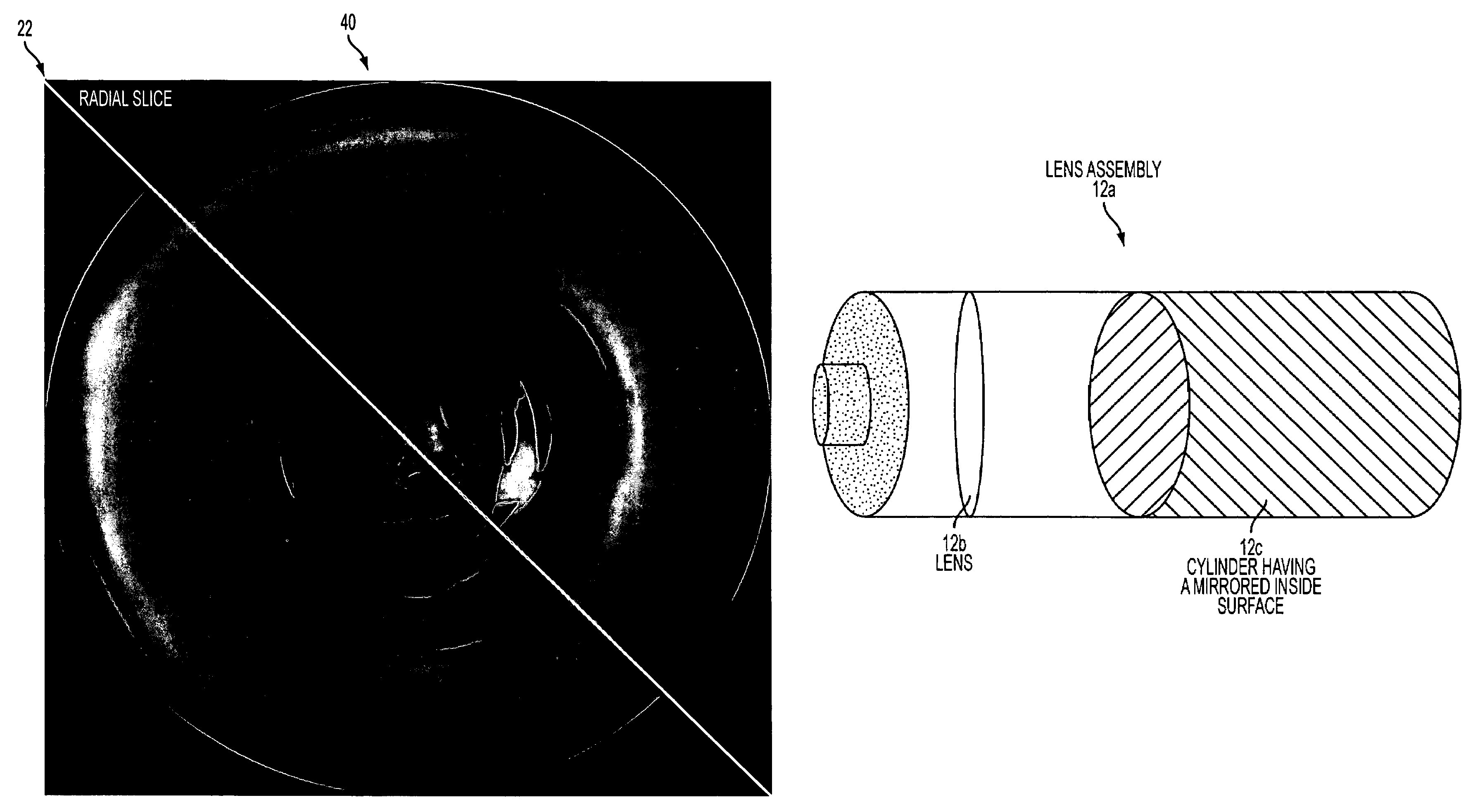 Catadioptric single camera systems having radial epipolar geometry and methods and means thereof