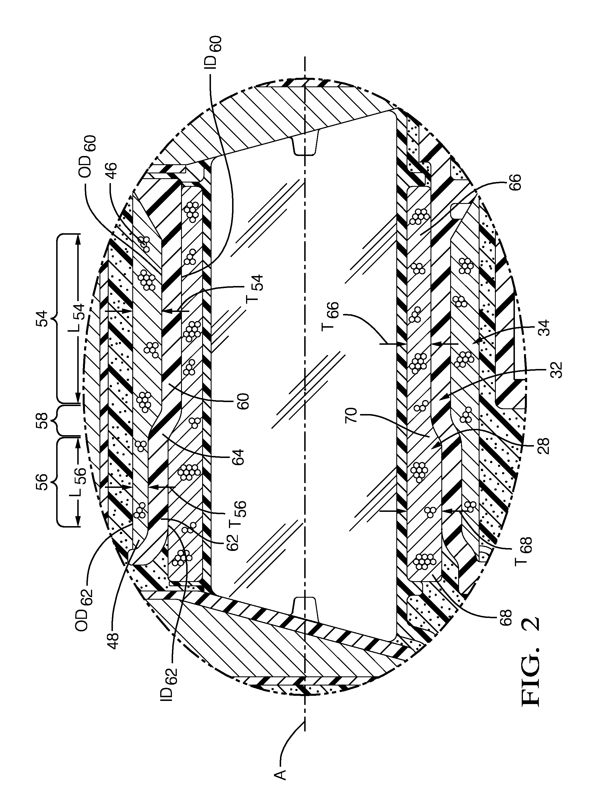 Ignition coil