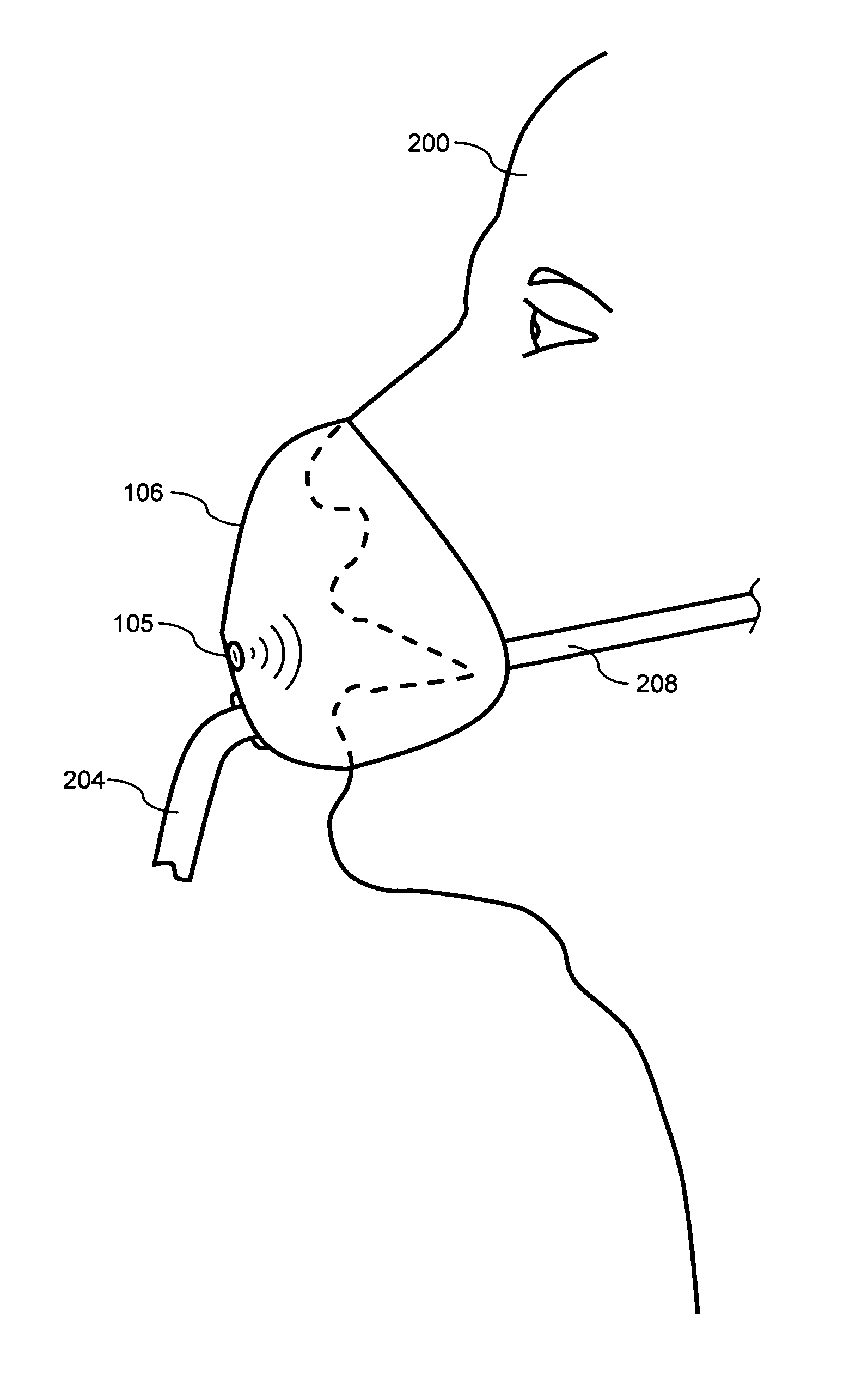 Unique device for determining airway obstructions
