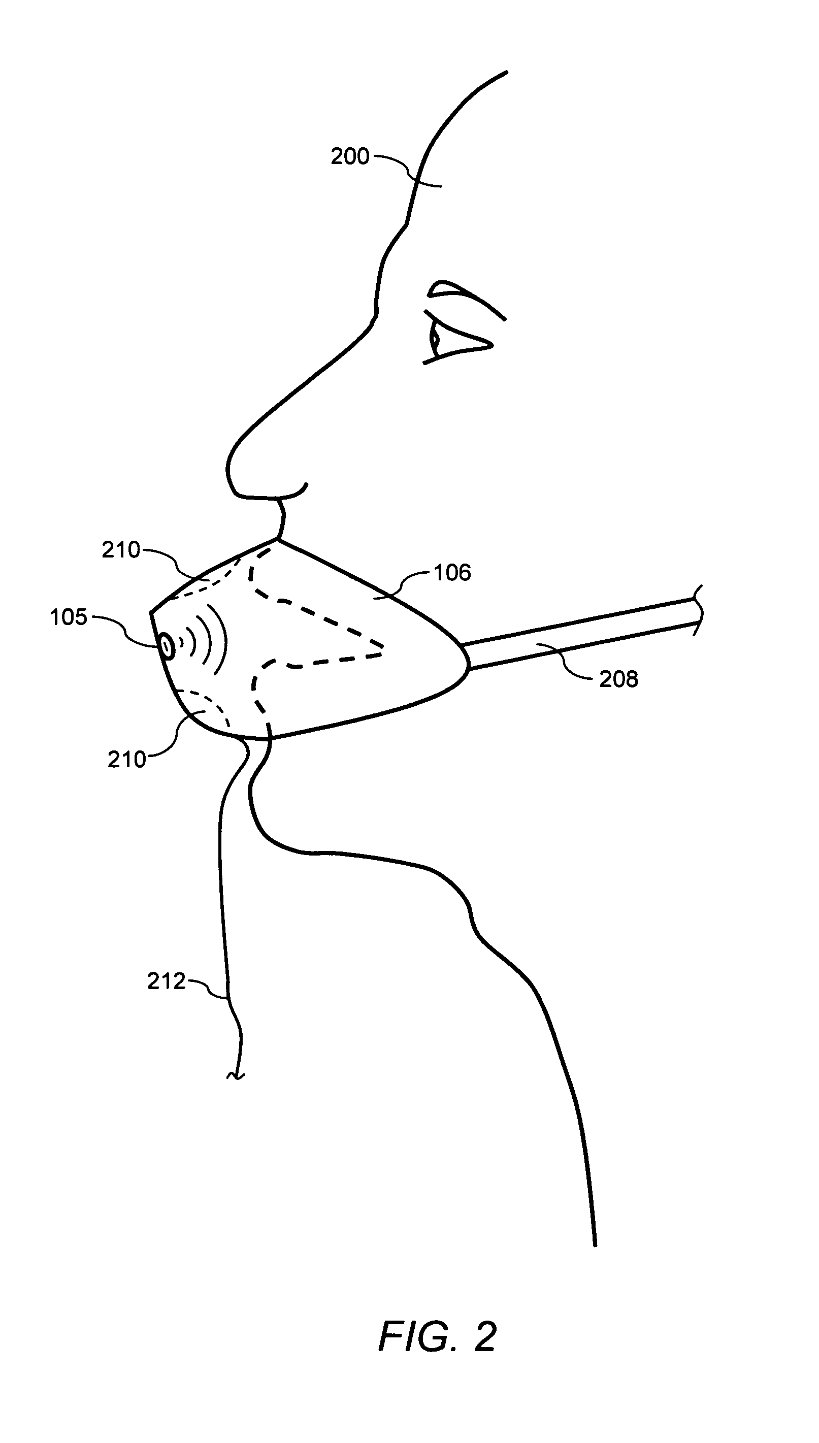 Unique device for determining airway obstructions