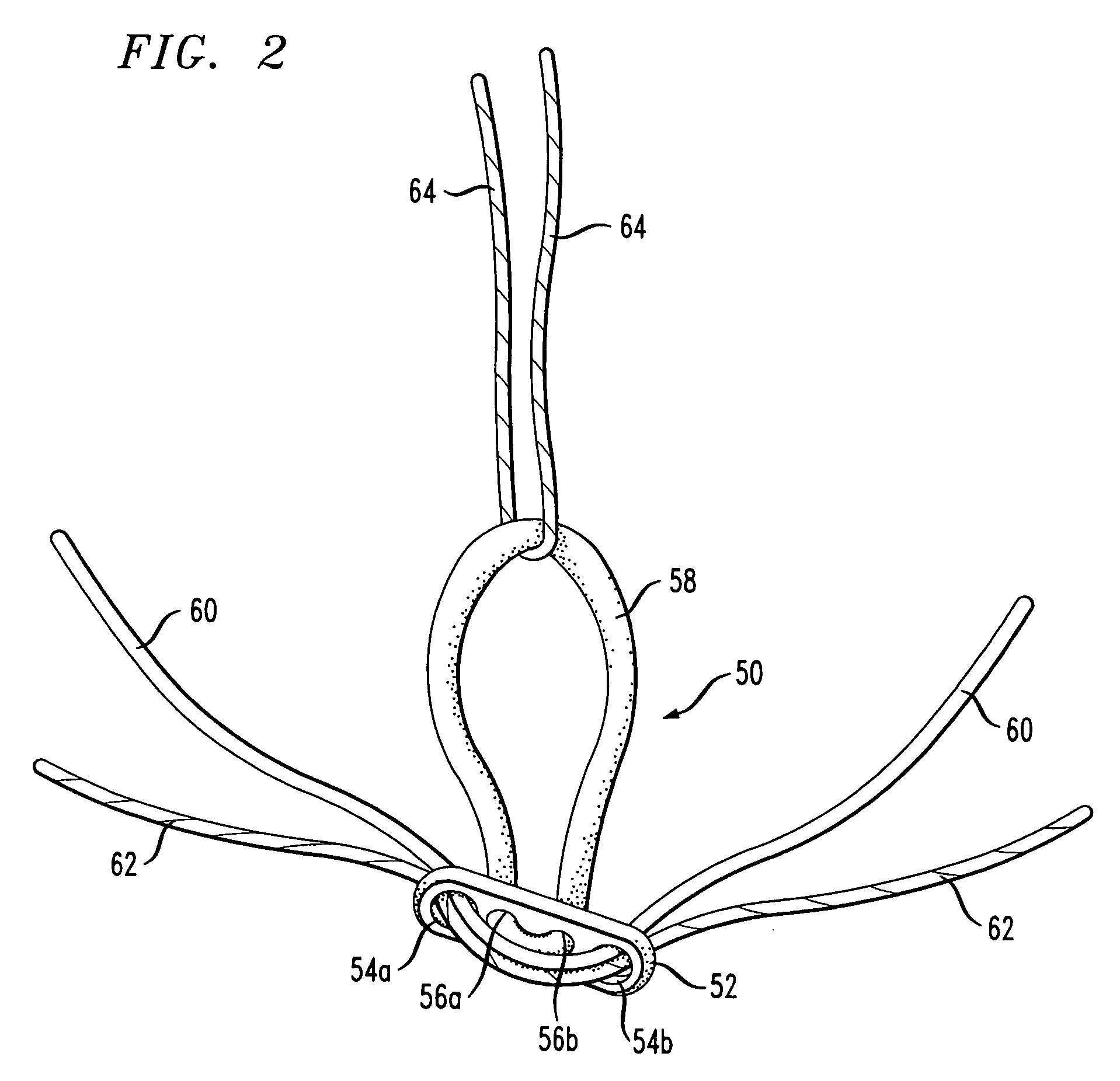Device for treatment of acromioclavicular joint dislocations