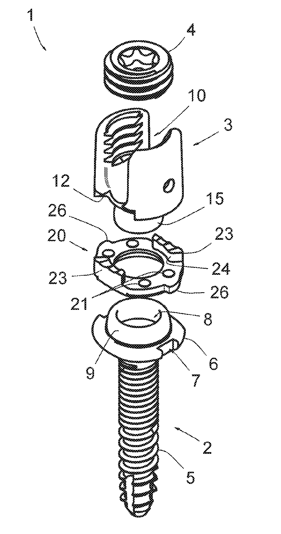 Vertebral osteosynthesis equipment