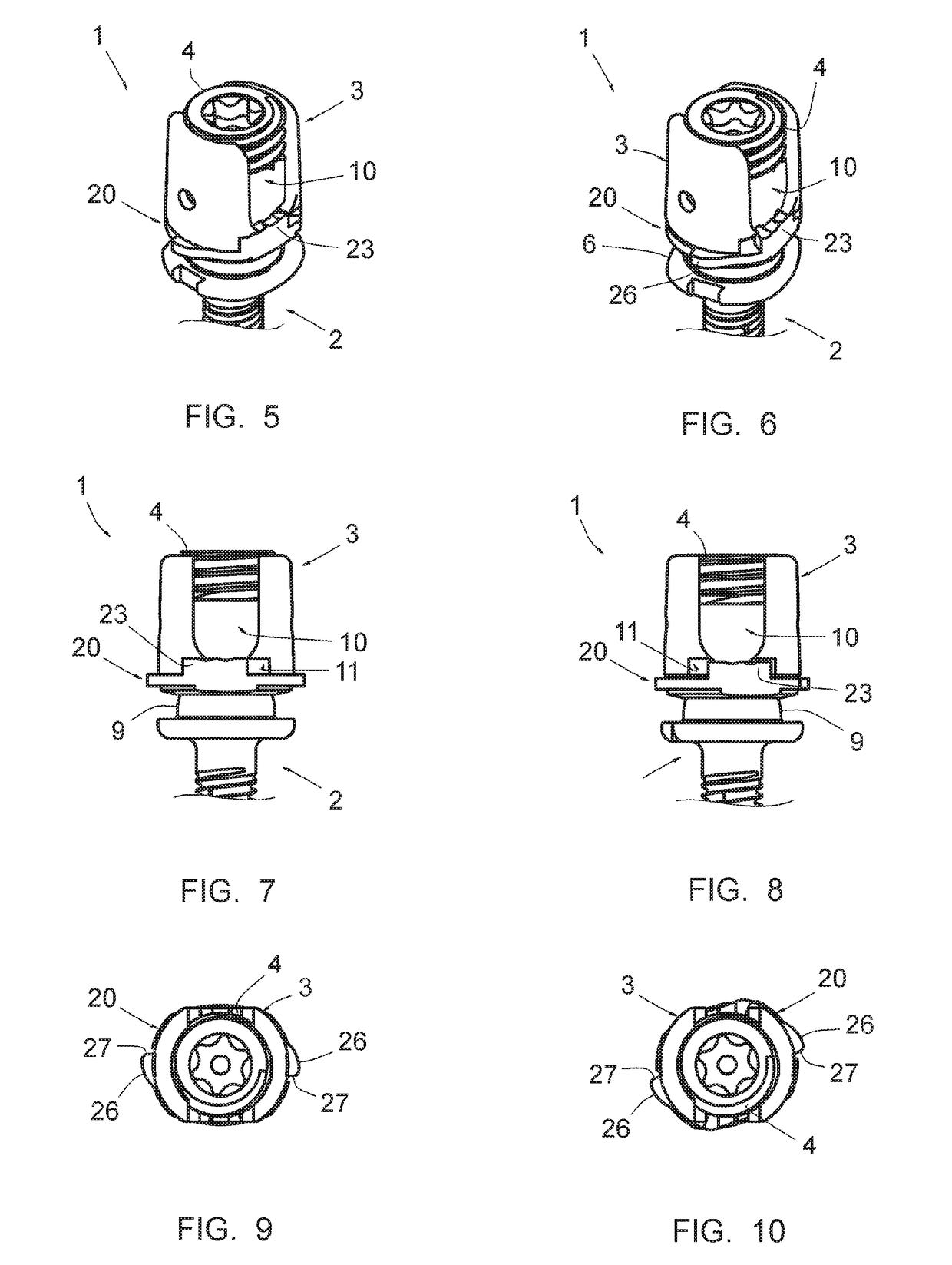 Vertebral osteosynthesis equipment