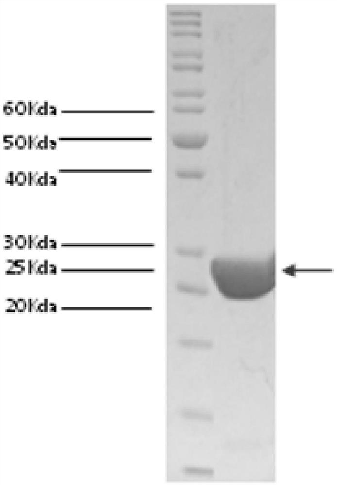 7beta-hydroxysteroid dehydrogenase mutant and application thereof