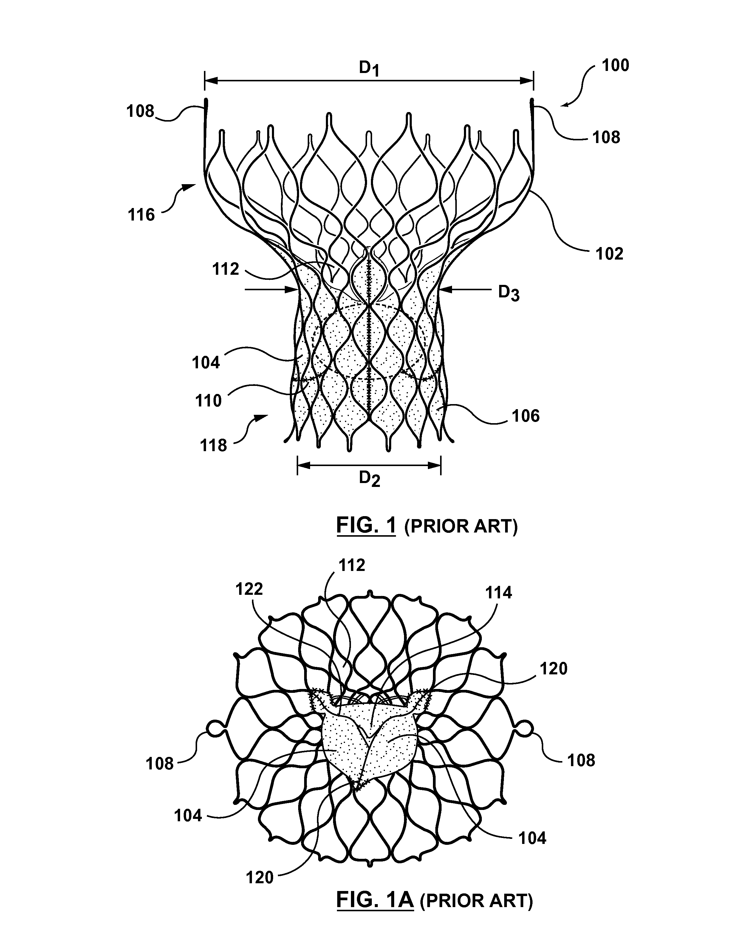 Transcatheter valve prostheses having a sealing component formed from tissue having an altered extracellular matrix