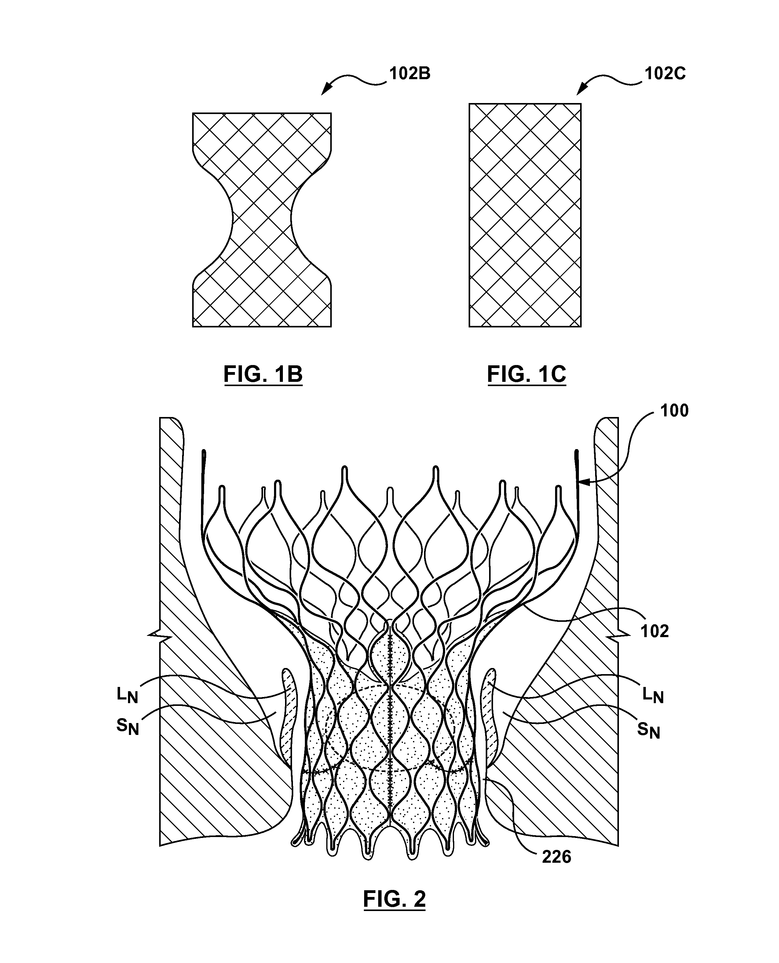 Transcatheter valve prostheses having a sealing component formed from tissue having an altered extracellular matrix