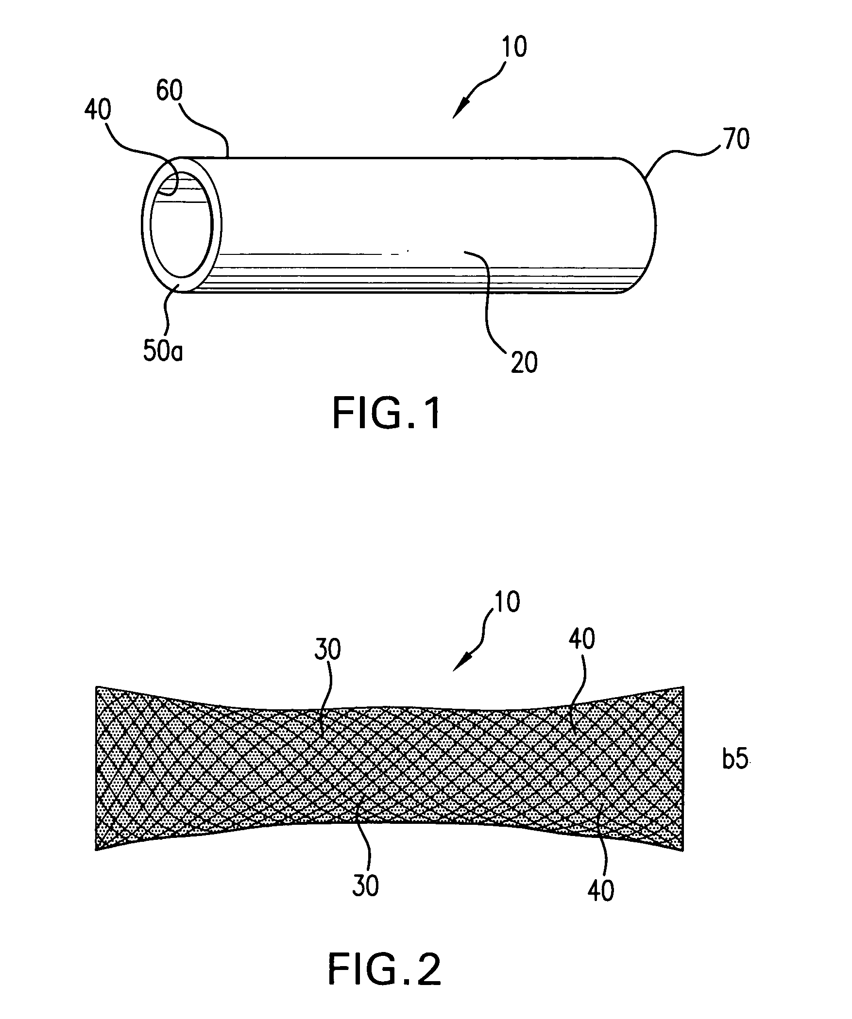 Method of manufacturing a covered stent