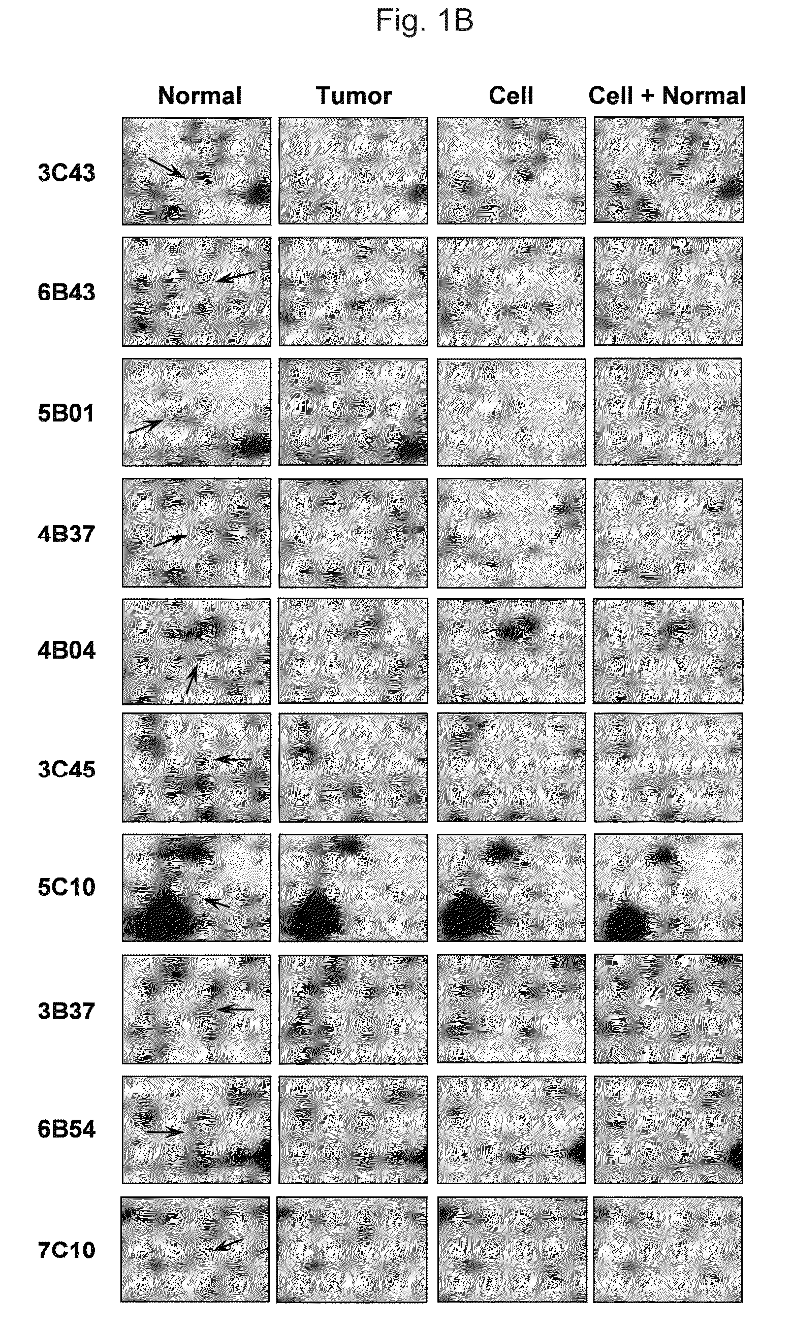 Methylation biomarker for early detection of gastric cancer