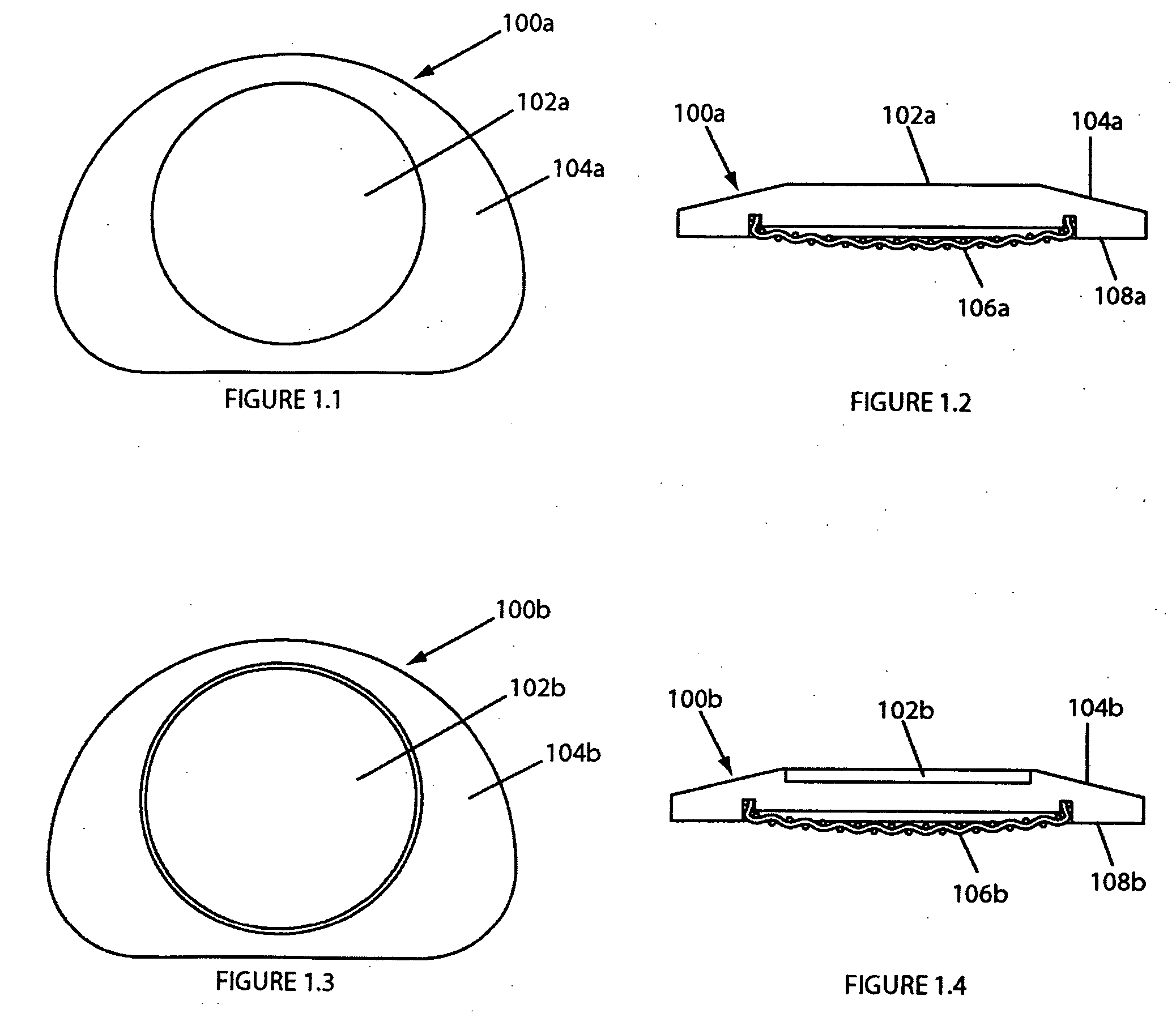 Intervertebral implant having features for controlling angulation thereof