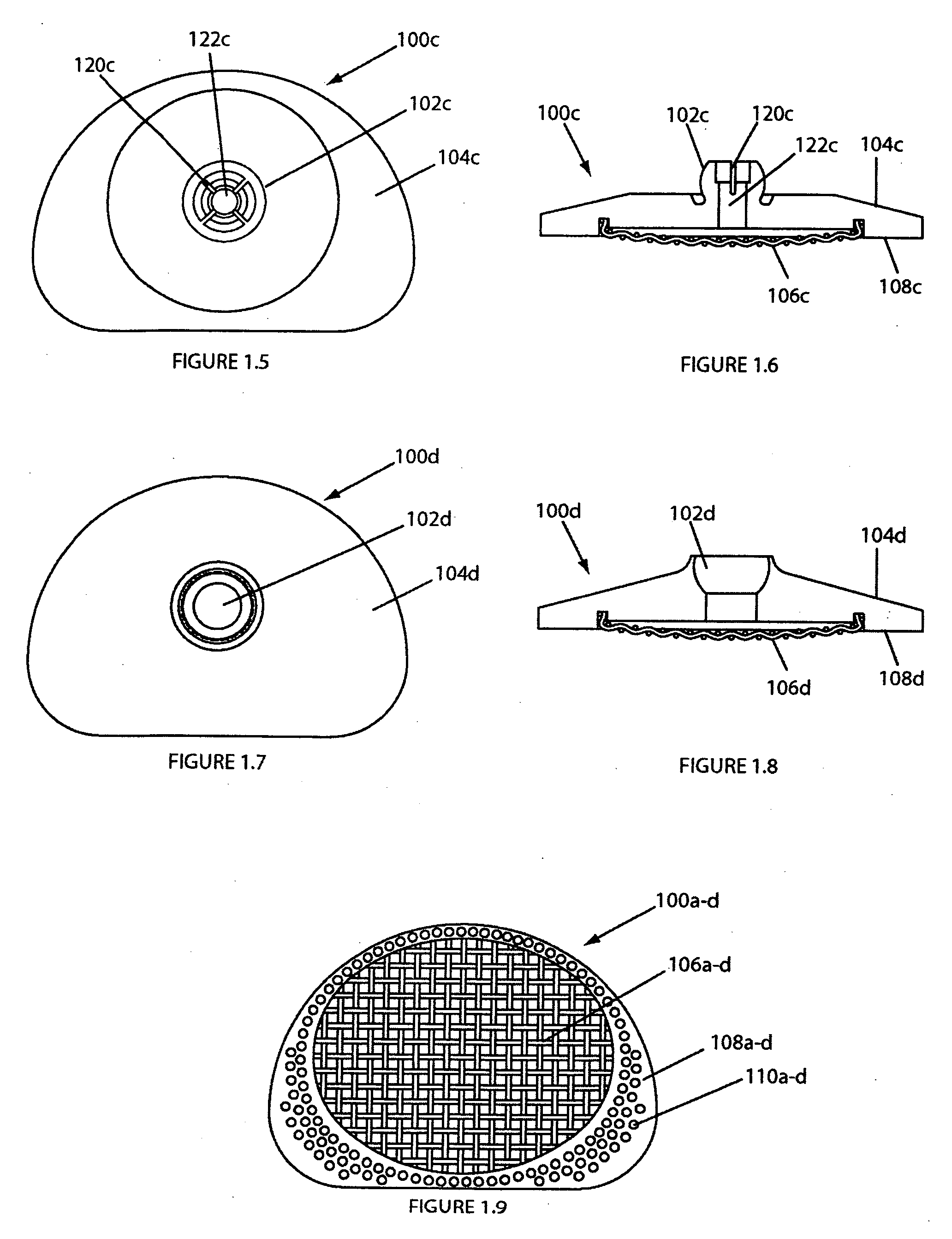 Intervertebral implant having features for controlling angulation thereof