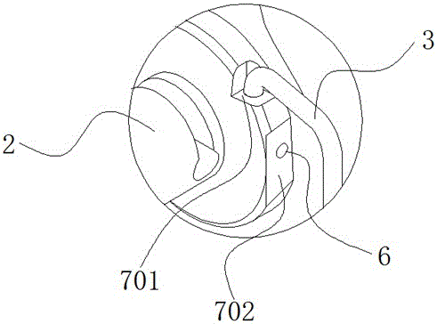 An ultrasonic negative pressure stone removal device in the body