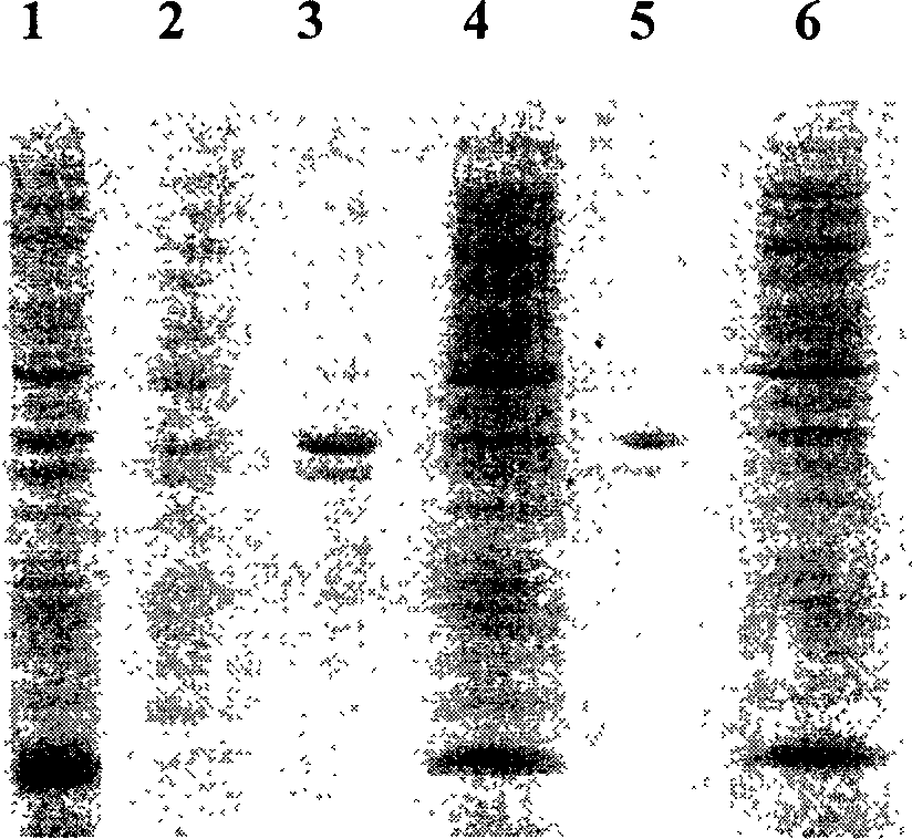 Horny cell growth factor mutant with high bioactivity and its preparation process and use thereof