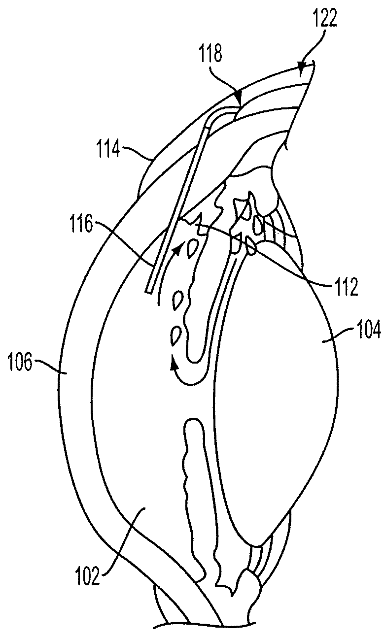 Systems and methods for monitoring and controlling internal pressure of an eye or body part