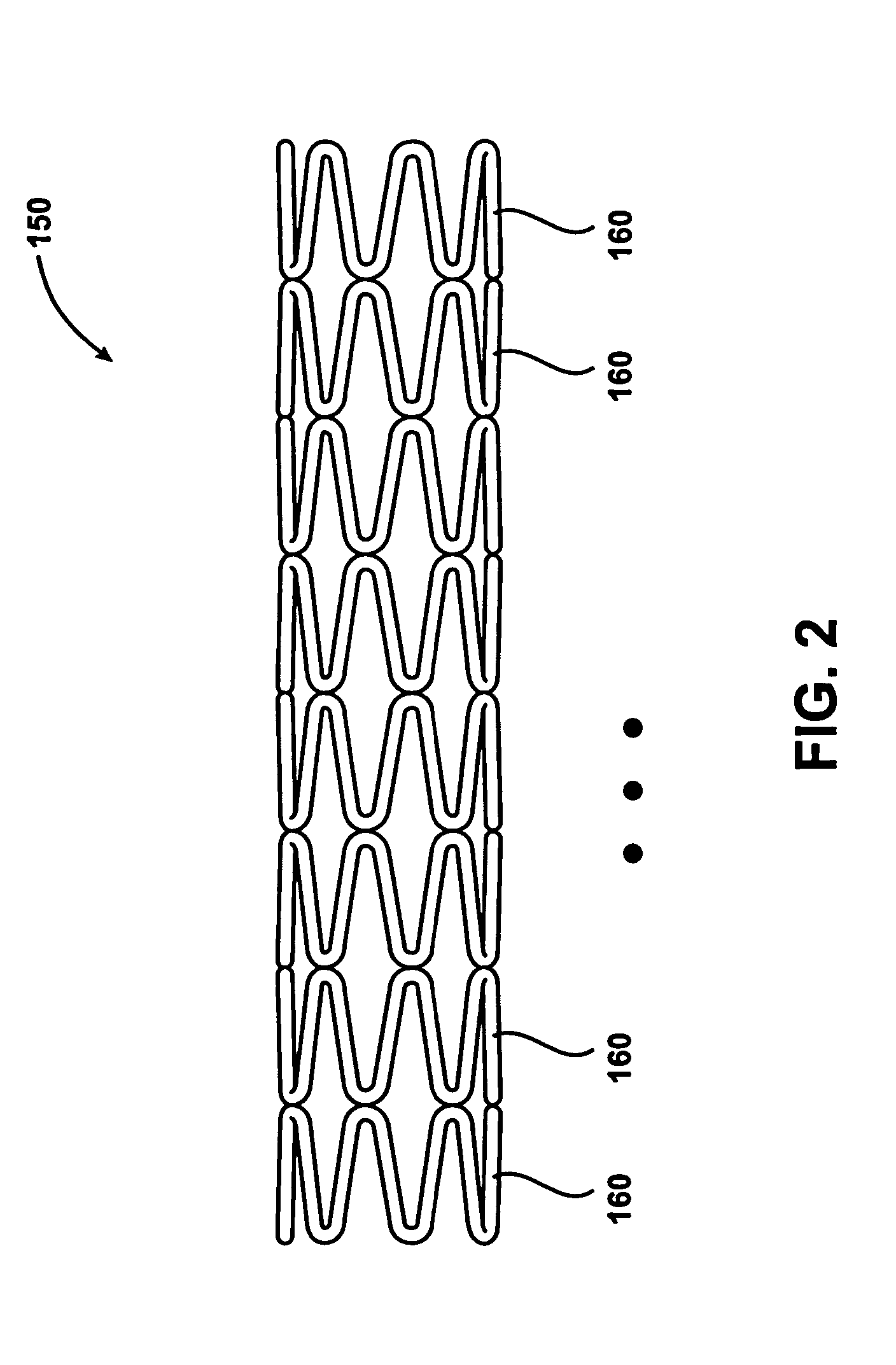 Gradient coated stent and method of fabrication