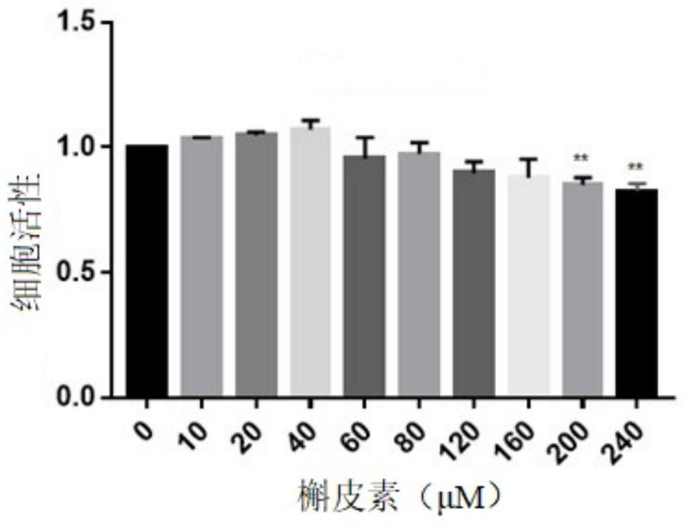 Application of quercetin in preparation of medicine for treating intervertebral disc nucleus pulposus degeneration