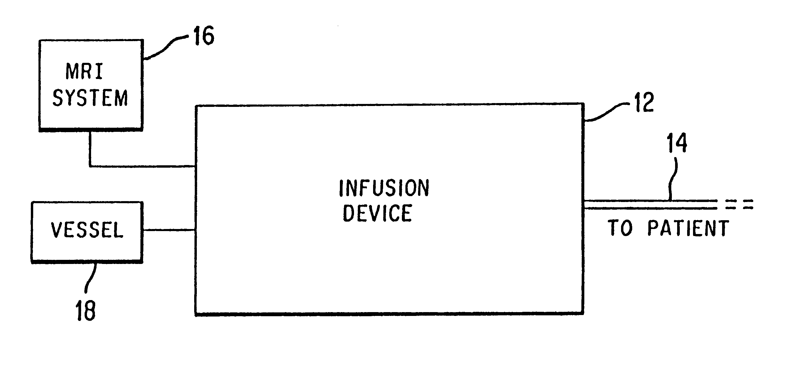 Method and apparatus for administration of contrast agents for use in magnetic resonance arteriography