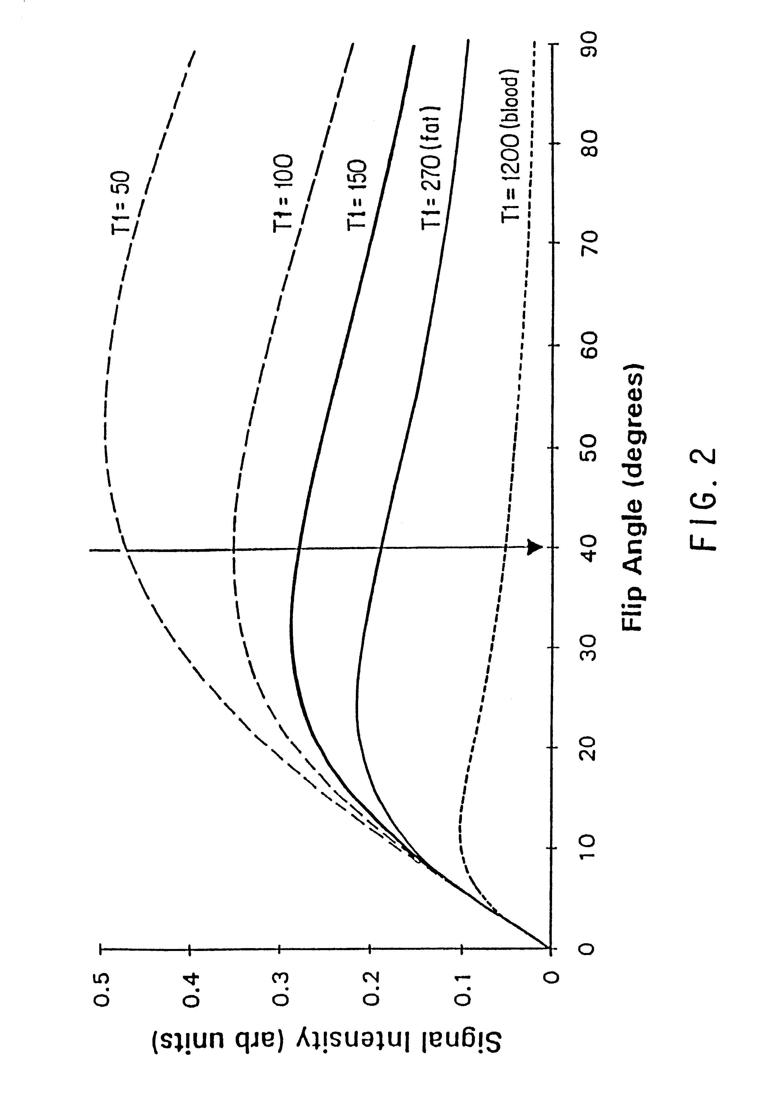 Method and apparatus for administration of contrast agents for use in magnetic resonance arteriography