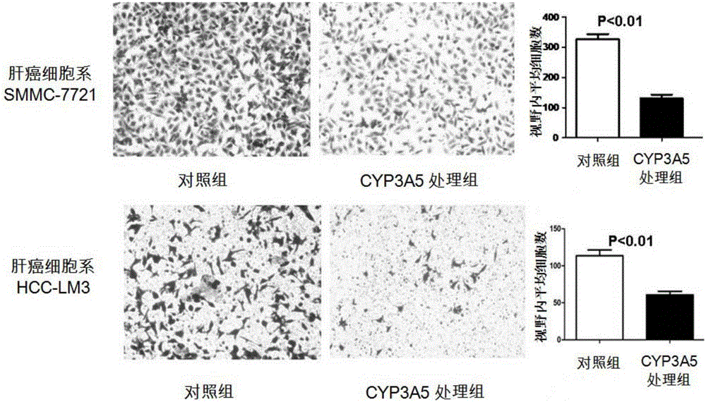 CYP3A5 protein, encoding gene and recombinant vector and application thereof in preparing drugs for resisting tumor recurrence or metastasis