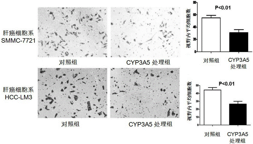 CYP3A5 protein, encoding gene and recombinant vector and application thereof in preparing drugs for resisting tumor recurrence or metastasis