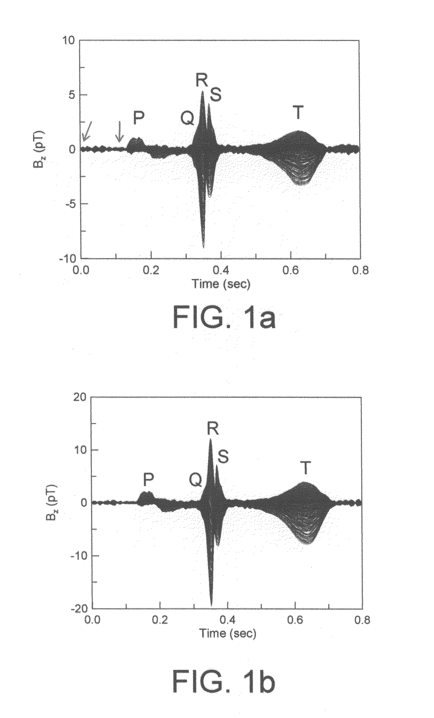 Method of examining dynamic cardiac electromagnetic activity and detection of cardiac functions using results thereof