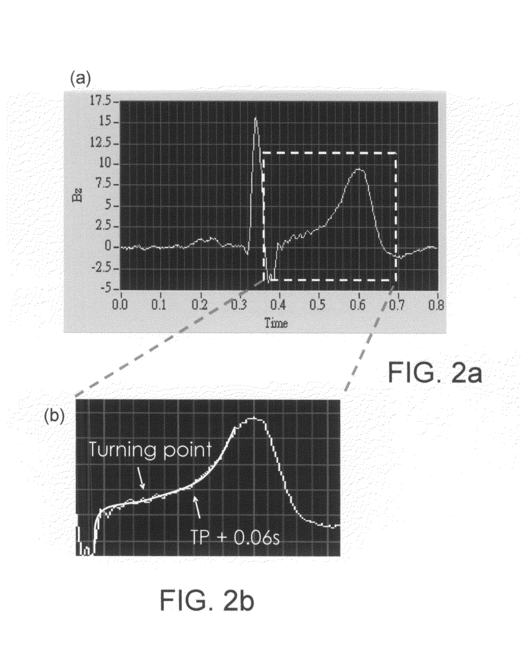 Method of examining dynamic cardiac electromagnetic activity and detection of cardiac functions using results thereof