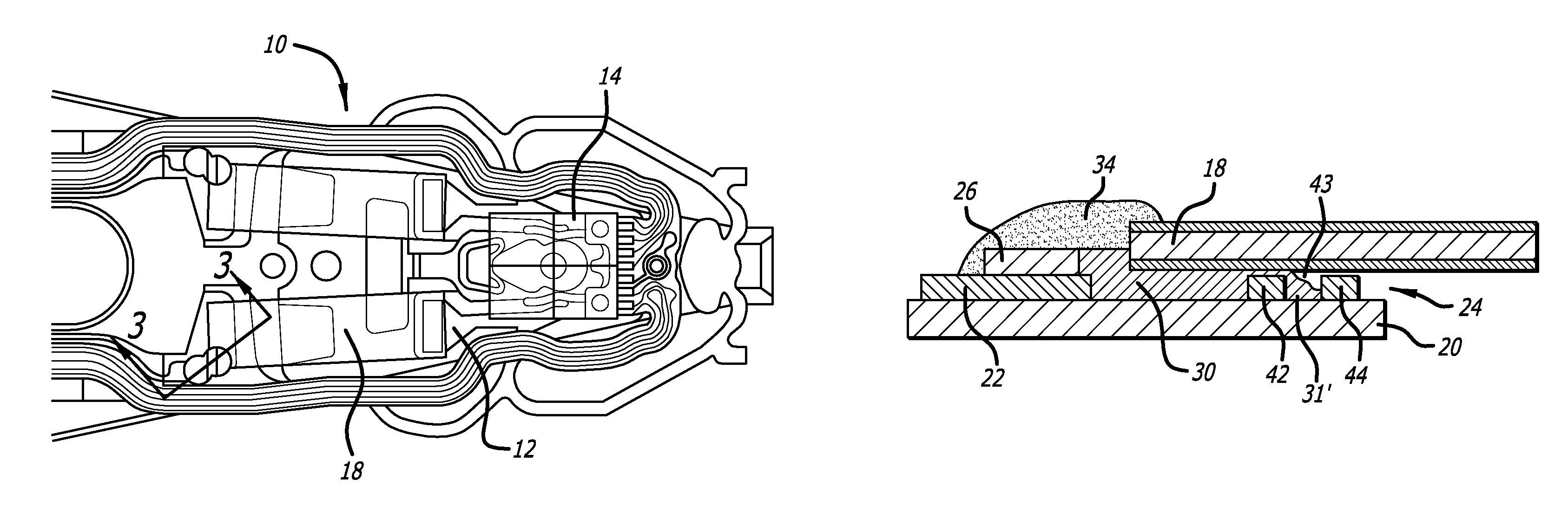 Dual stage actuated suspension having adhesive overflow control channels