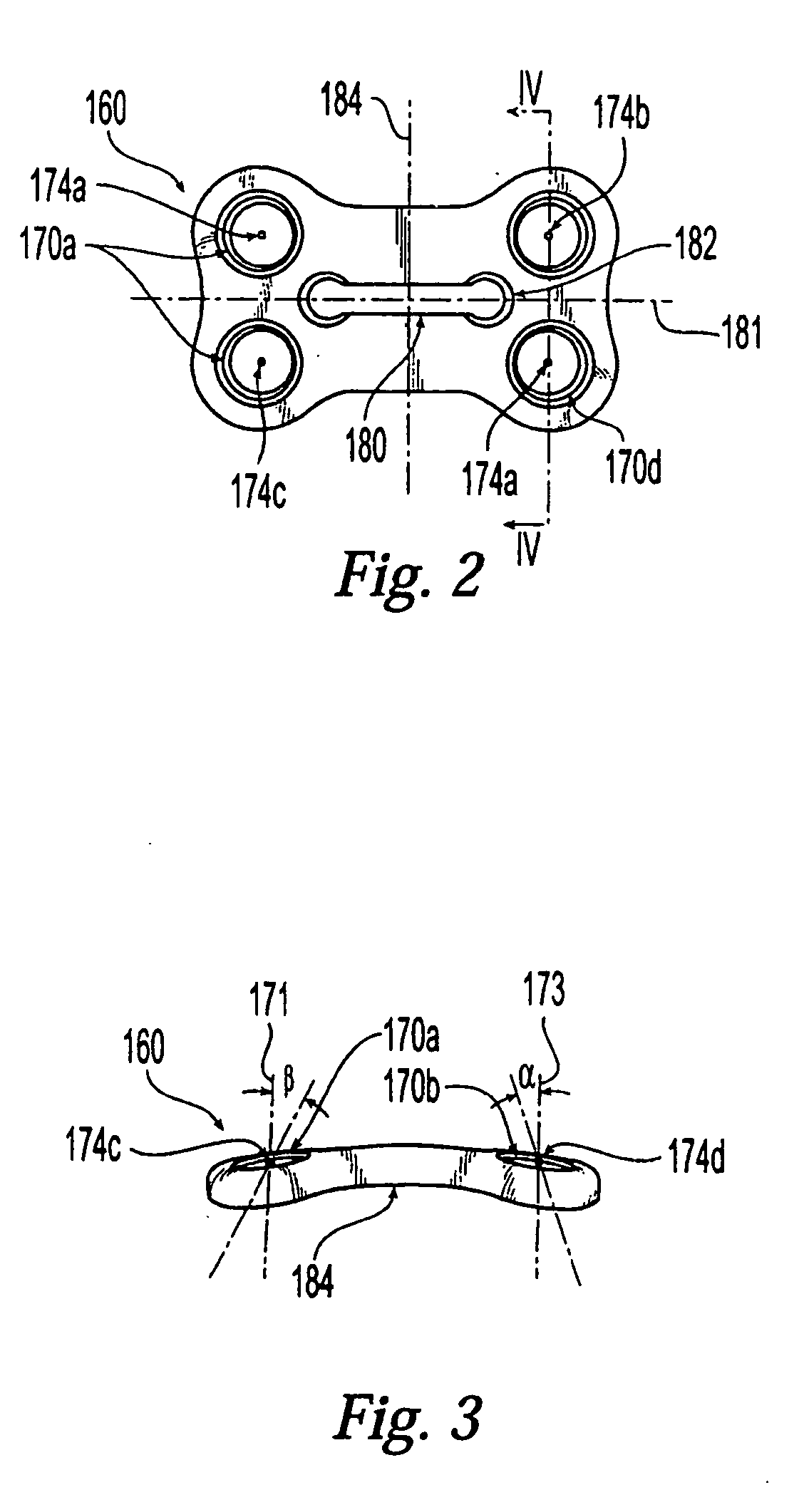 Plating system with compression drill guide
