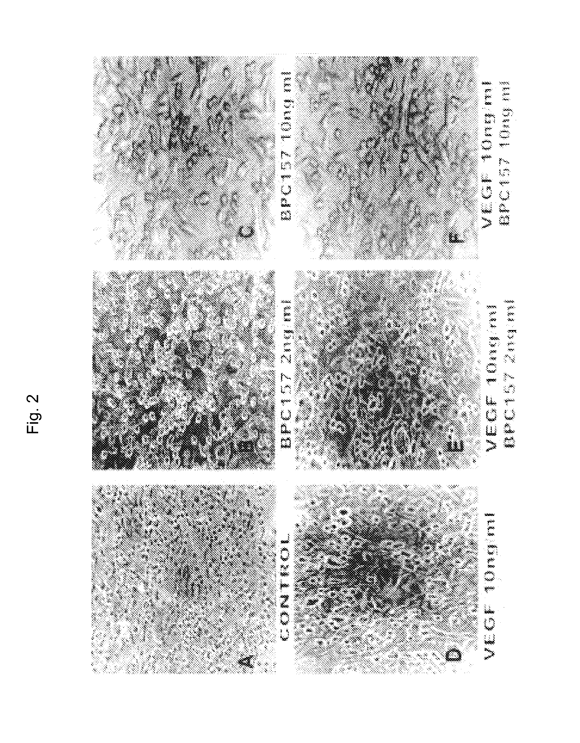 New stable pentadecapeptide salts, a process for preparation thereof, a use thereof in the manufacture of pharmaceutical preparations and a use thereof in therapy