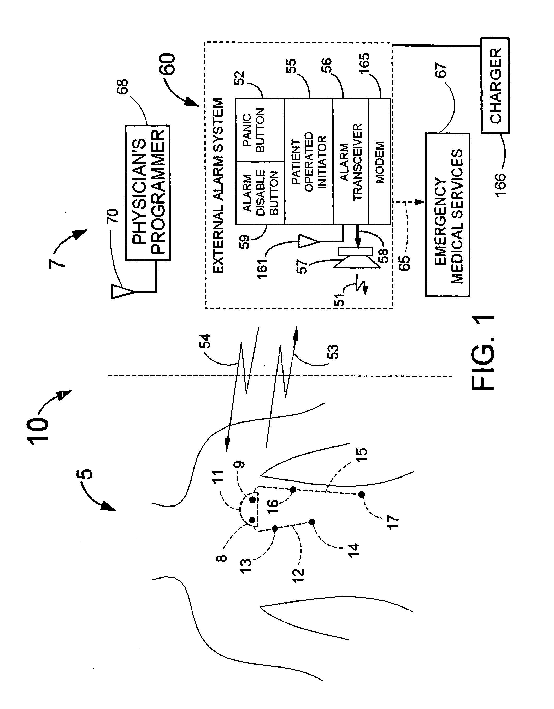 Means and method for the detection of cardiac events