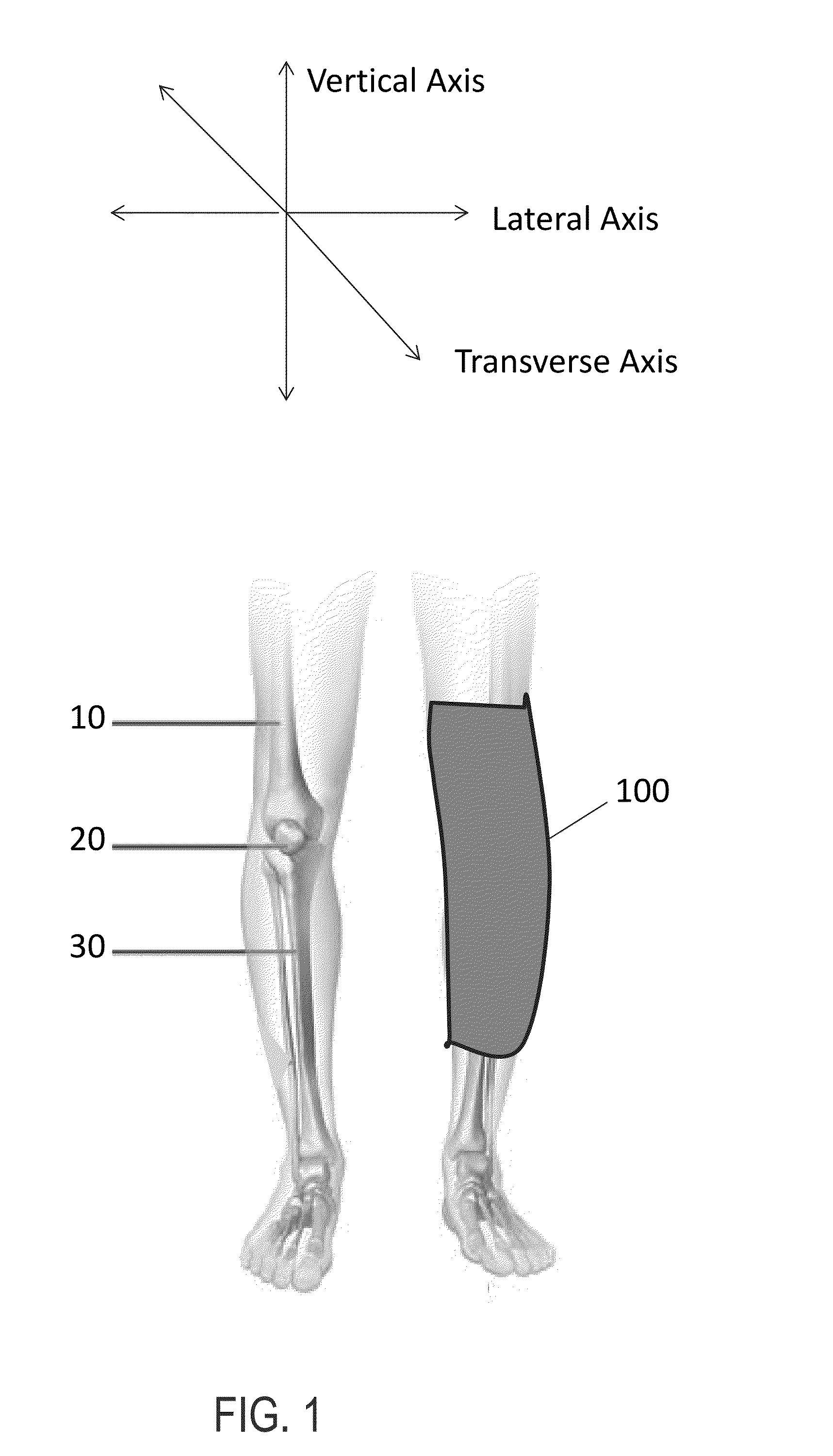 Wearable device configured to detect improper movement of a knee and alert wearers to the improper movement