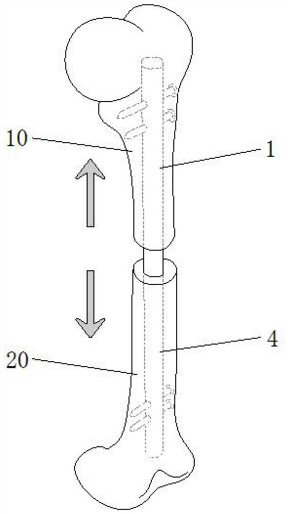 Magnetism driving epiphysis traction and pressurization device