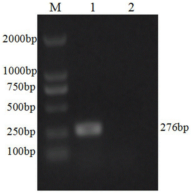 Dual fluorescence RT-PCR (Reverse Transcription-Polymerase Chain Reaction) detection method for PDCoV (porcine Delta coronavirus) and PEDV (porcine epidemic diarrhea virus) and application thereof