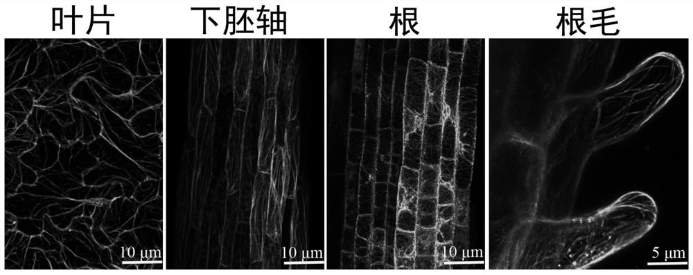Fusion protein and encoding gene for labeling microtubule skeleton, method for constructing transgenic leguminous plants