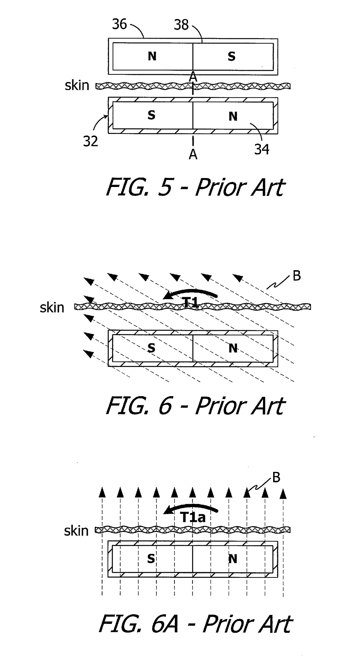 Cochlear implants having mri-compatible magnet apparatus