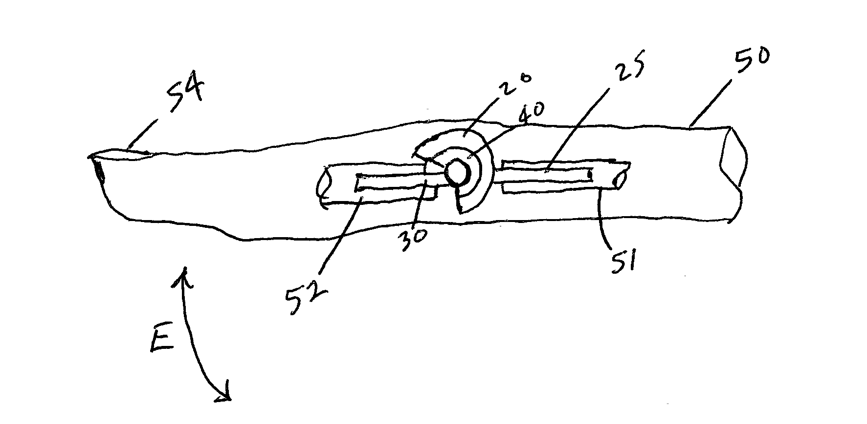Implants and Methods of Making and Using the Same