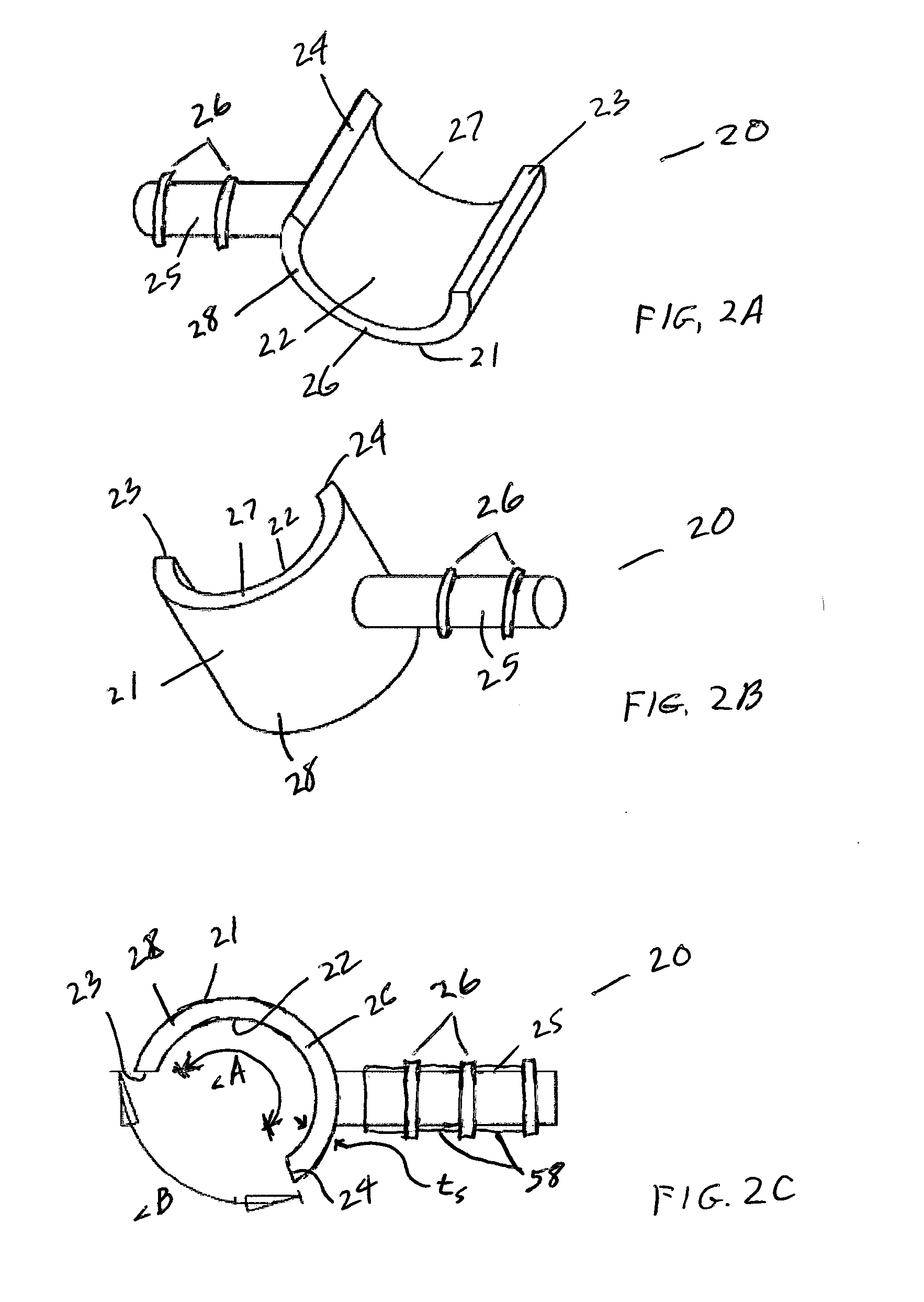 Implants and Methods of Making and Using the Same