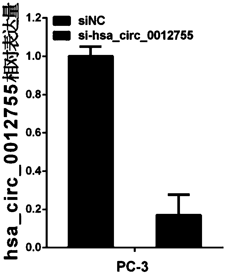 Application of hsa_circ_0012755 as prostatic cancer molecular target in preparing medicine and kit
