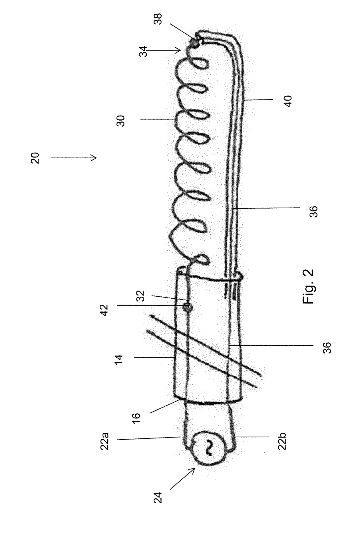 Electrochemical protection of conducting circuit in the body of a patient