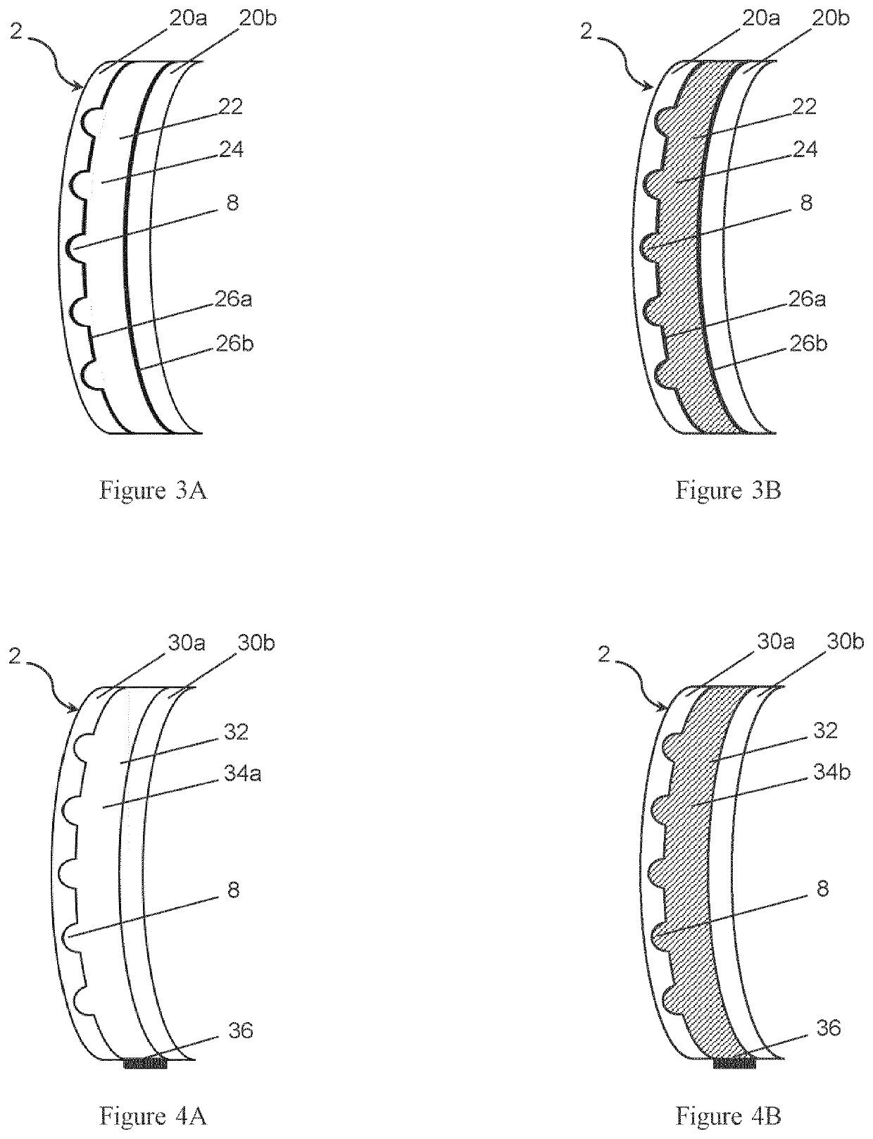 Active lens adapted for correcting an abnormal refraction of an eye of a wearer