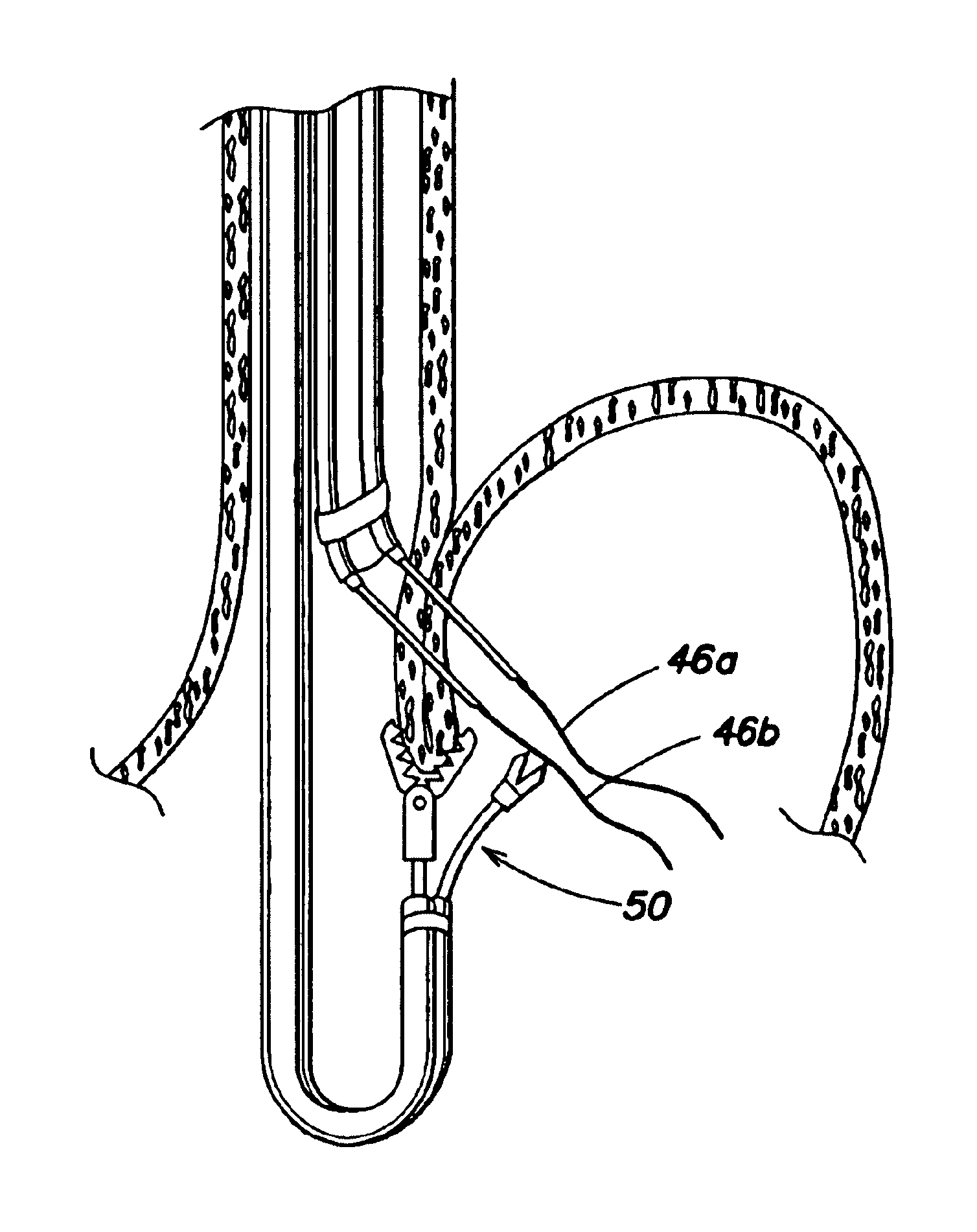 Endoscopic instrument for forming an artificial valve