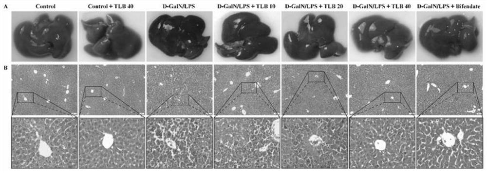 Application of trilobatin in preparation of medicine for treating acute liver injury