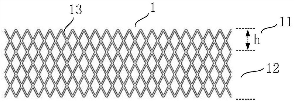 Interventional mitral valve stent