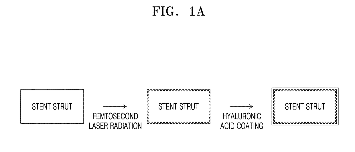 Stent for inhibiting restenosis and stimulating reendothelialization prepared by femtosecond laser processing and method of preparing the same