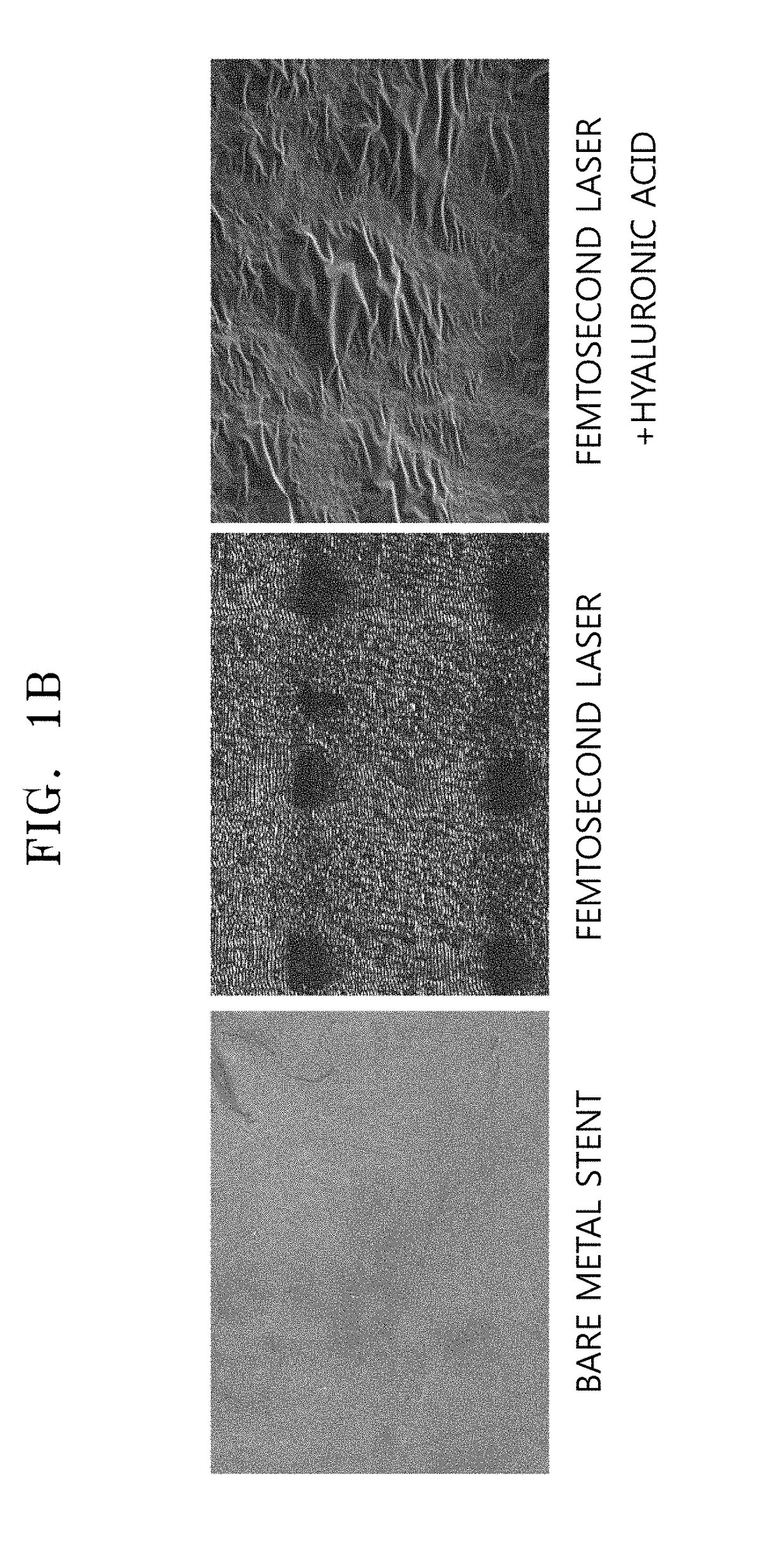 Stent for inhibiting restenosis and stimulating reendothelialization prepared by femtosecond laser processing and method of preparing the same